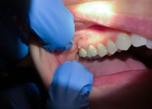 Best Teeth Whitening  in Saukville, WI